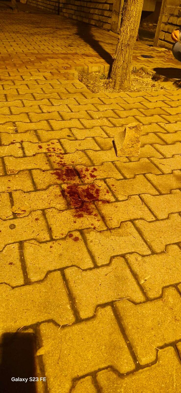 Konya’da kafatası parçalanan çocuk taburcu oldu, saldırgan “baba tahliye” paylaştı 11